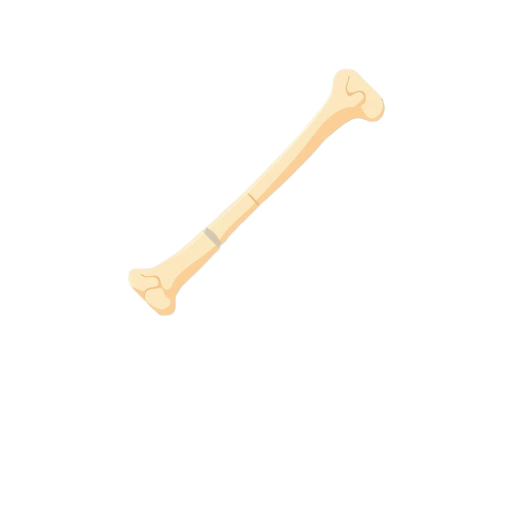 Ilustración de un hueso fracturado
